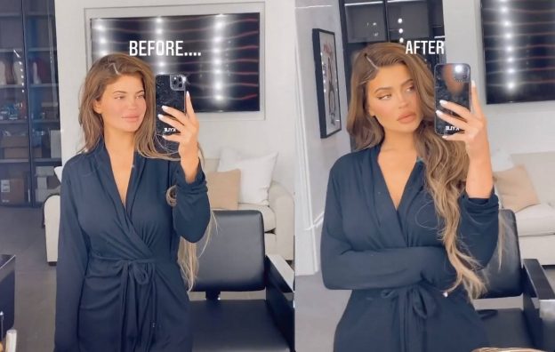 Kylie Jenner "Before" And "After" Makeup