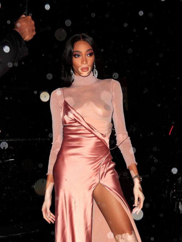 Winnie Harlow TheFappening Sexy (16 Photos)